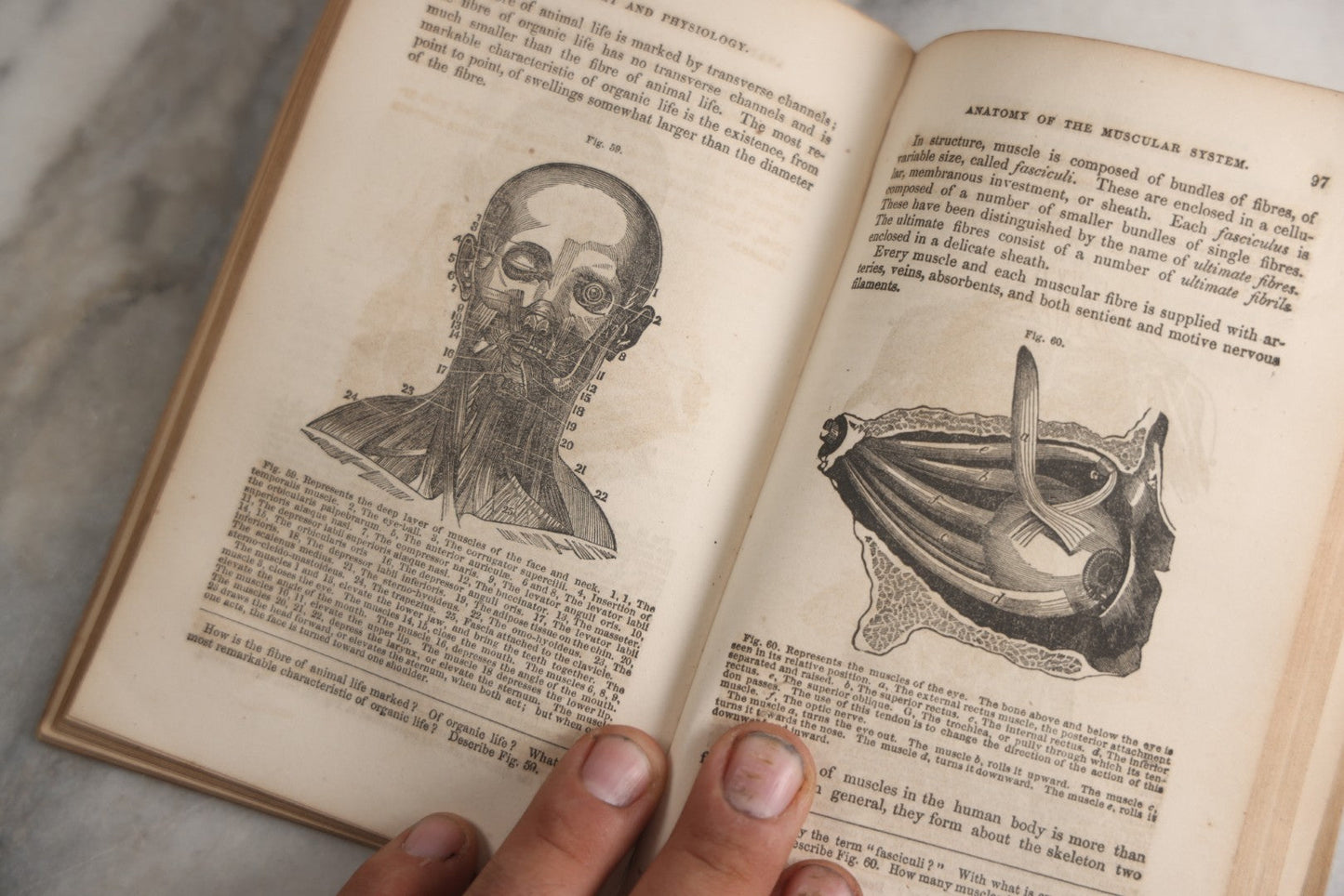 Lot 171 - "Anatomy And Physiology: Designed For Academies And Families" Antique Medical Book By Calvin Cutter, M.D., Sixth Stereotype Edition, Illustrated With Over 200 Engravings, Benjamin B. Mussey & Co., Publishers, Boston, 1847, Note Missing Covers