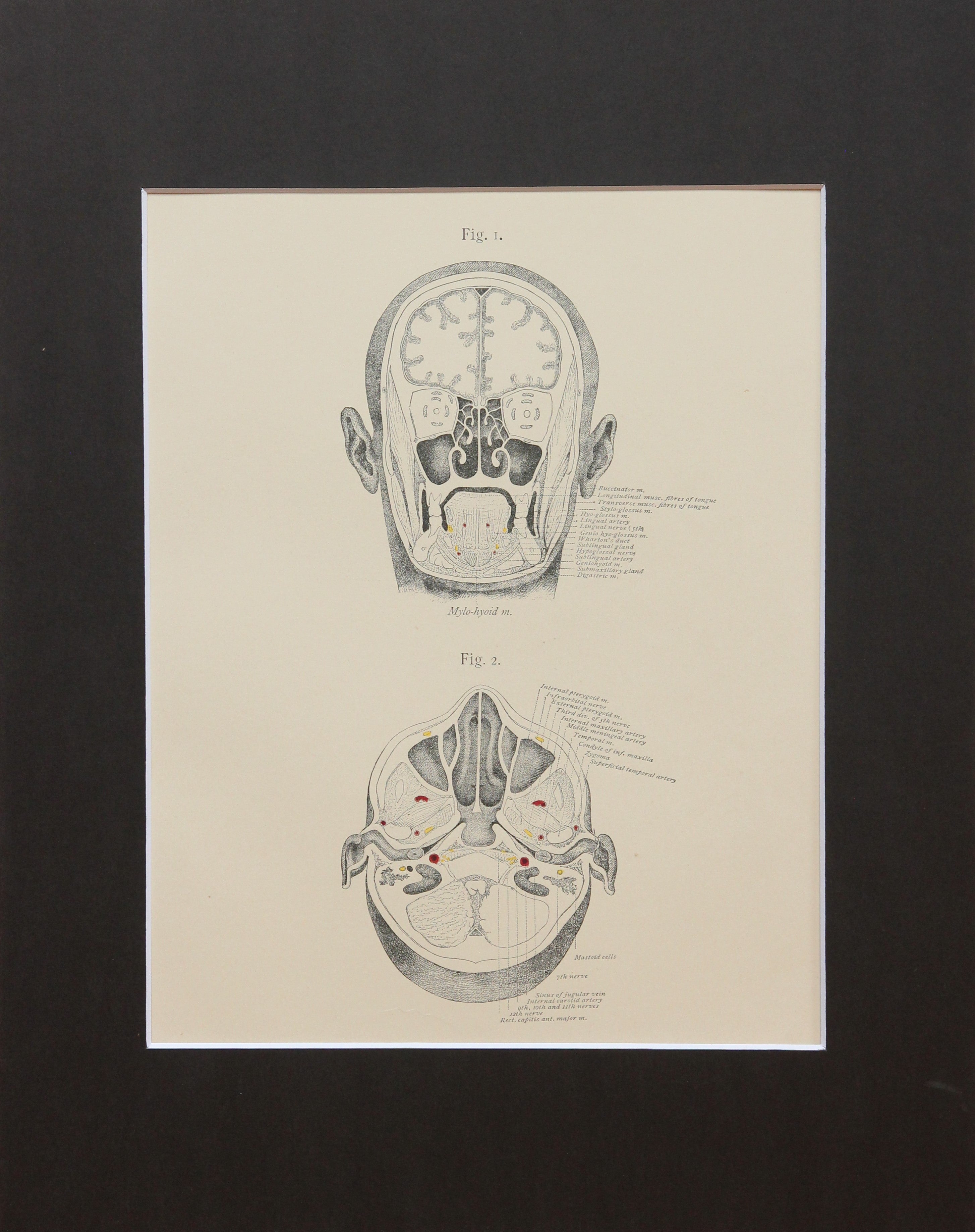 Matted Antique (c.1897) Anatomy Print, Plate VII: Sections of the Head ...