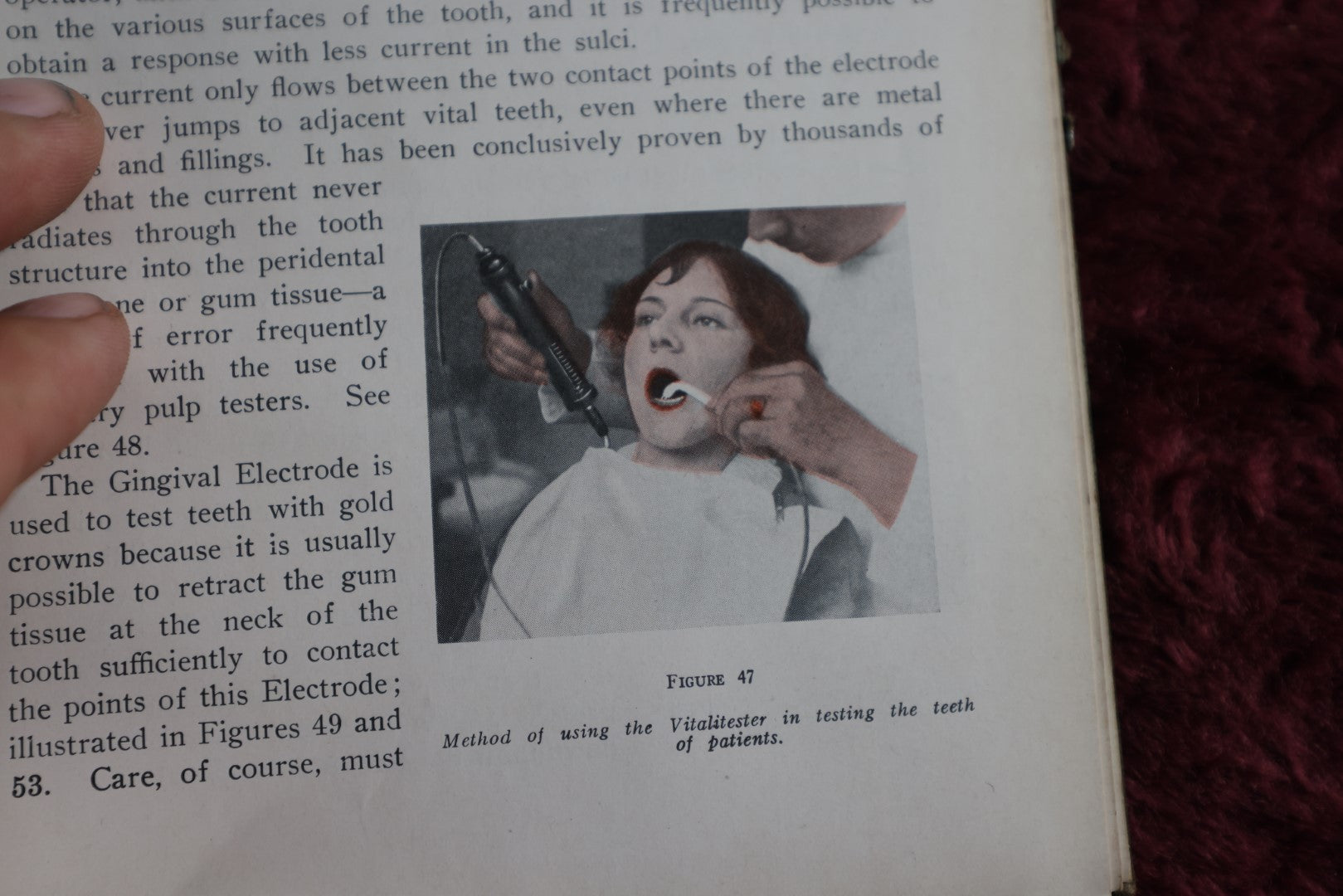 Lot 148 - Diagnosis By Transillumination Antique Medical Book, By W.J. Cameron, 1927, Illustrated, Plus Related Pamphlet