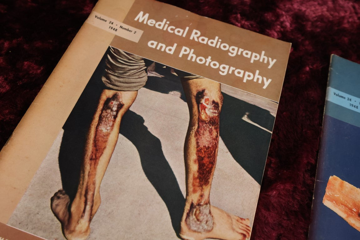 Lot 142 - Fifteen Piece Grouping Of Medical Radiography And Photography Books, 1940s And 1950s