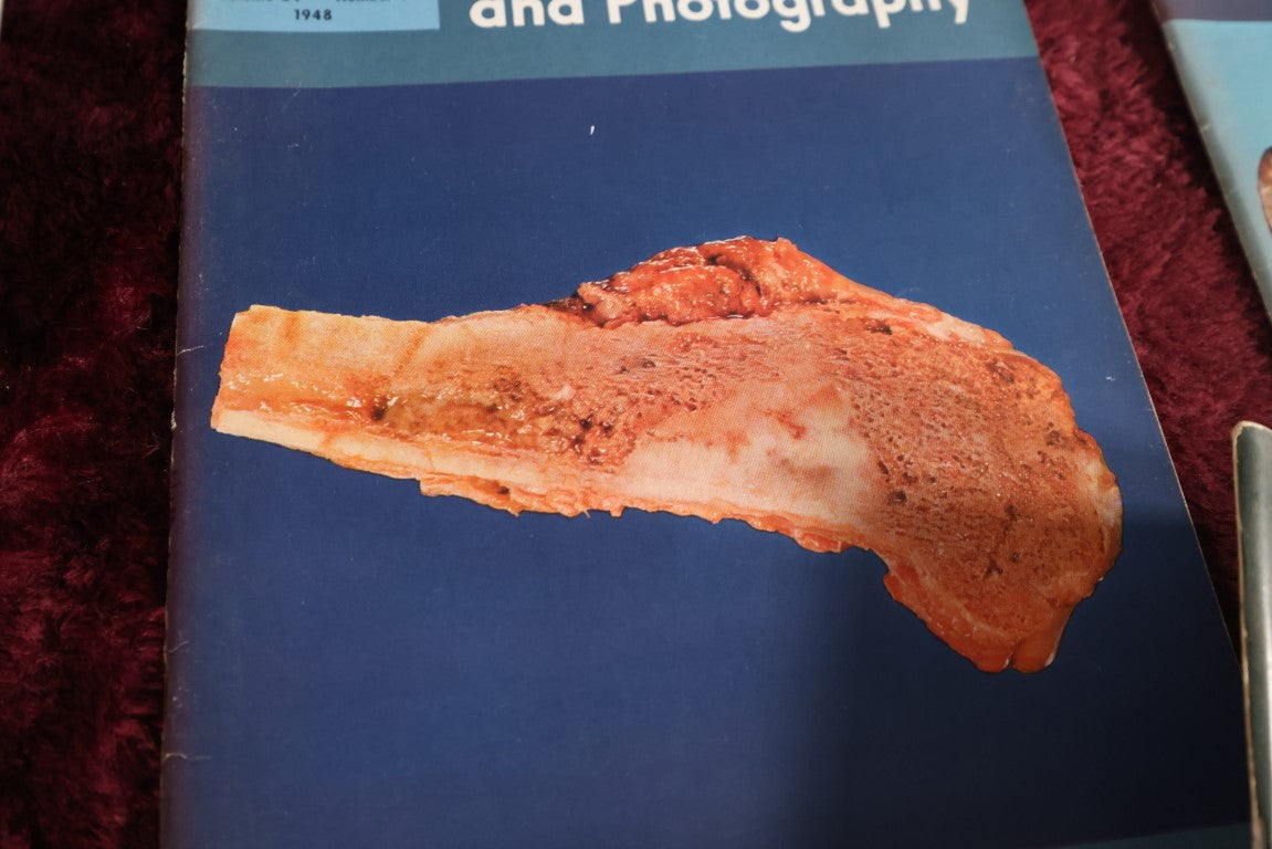 Lot 142 - Fifteen Piece Grouping Of Medical Radiography And Photography Books, 1940s And 1950s