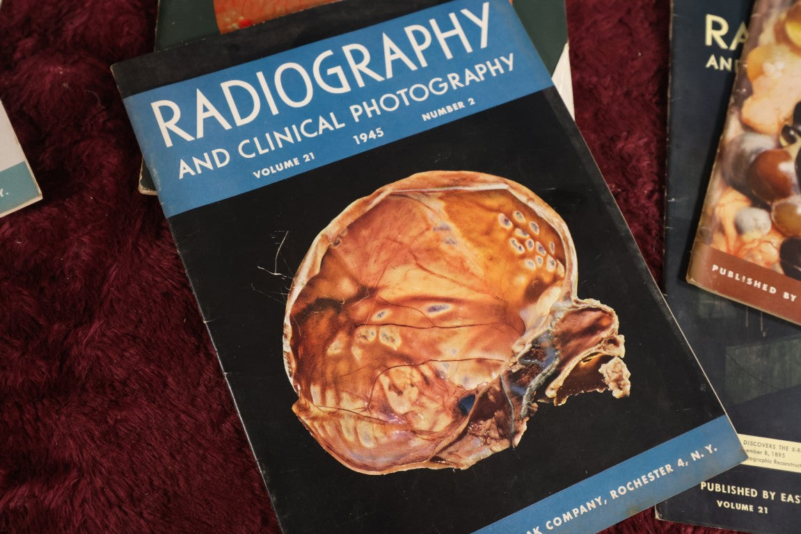 Lot 142 - Fifteen Piece Grouping Of Medical Radiography And Photography Books, 1940s And 1950s