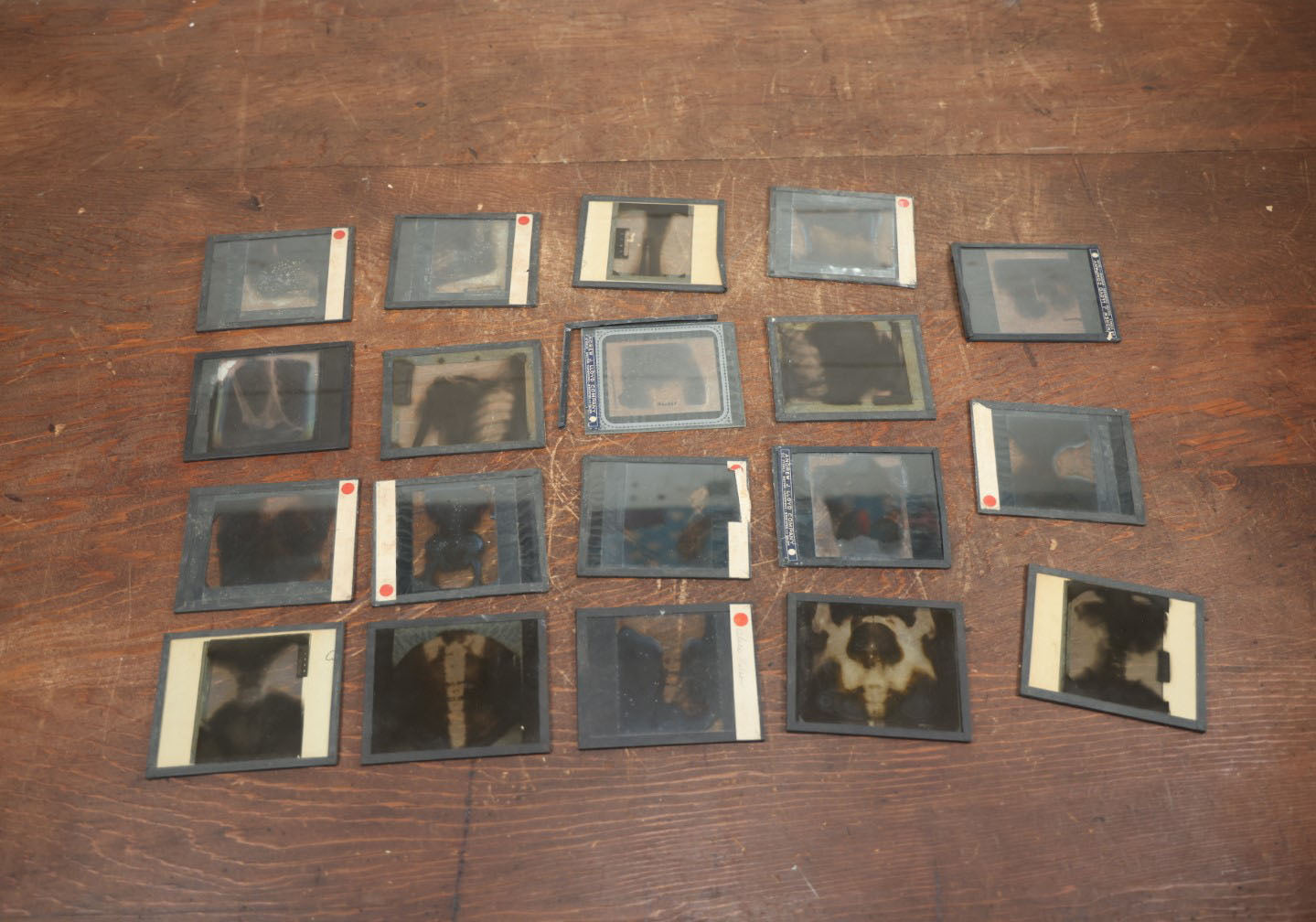 Lot 042 - Grouping Of Nineteen Antique Magic Lantern Slide X-Rays Of The Pelvis, Ribs, Chest, Shoulders, Torso