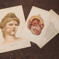 Lot 104 - Pair Of Antique Chromolithograph Medical Book Plates Depicting Skin Lesions, Lupus, Munich And Stockholm