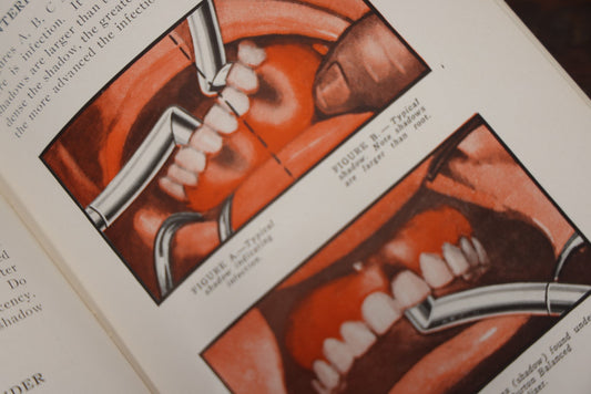 Lot 089 - "Indicative Oral Diagnosis, Fourth Edition" Vintage Dental And Orthodontics Book, By Burton Manufacturing Co., Chicago, Illustrations Of Teeth And More, 1936