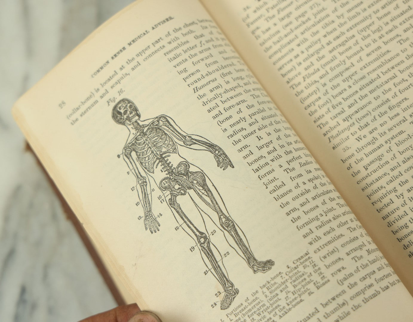 Lot 122 - "The People's Common Sense Medical Adviser In Plain English, Or, Medicine Simplified" Antique Illustrated Medical Book By R.V. Pierce, M.D., Twelfth Revised Edition, Buffalo, New York, 1883