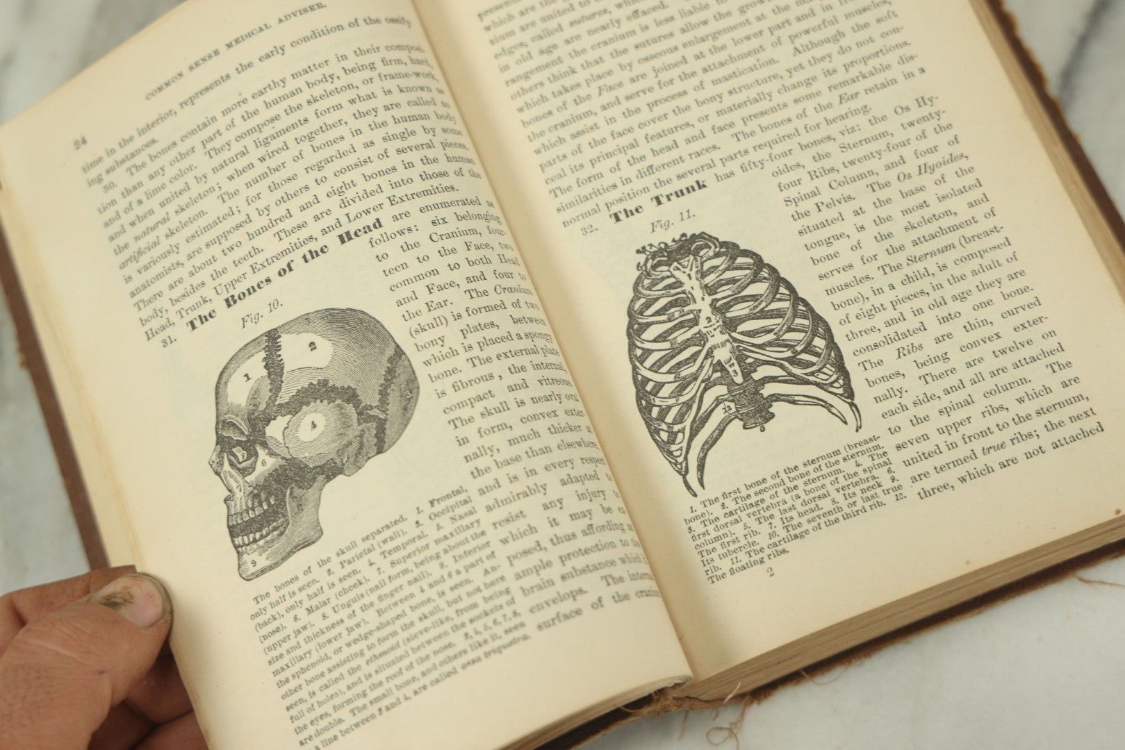 Lot 122 - "The People's Common Sense Medical Adviser In Plain English, Or, Medicine Simplified" Antique Illustrated Medical Book By R.V. Pierce, M.D., Twelfth Revised Edition, Buffalo, New York, 1883
