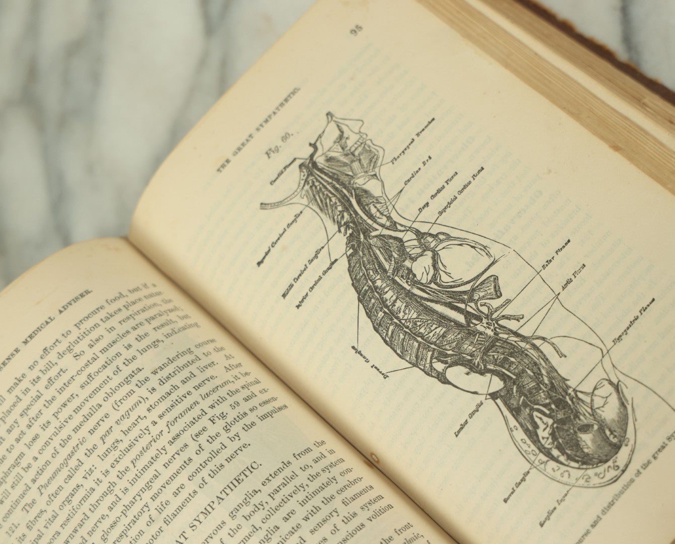 Lot 122 - "The People's Common Sense Medical Adviser In Plain English, Or, Medicine Simplified" Antique Illustrated Medical Book By R.V. Pierce, M.D., Twelfth Revised Edition, Buffalo, New York, 1883
