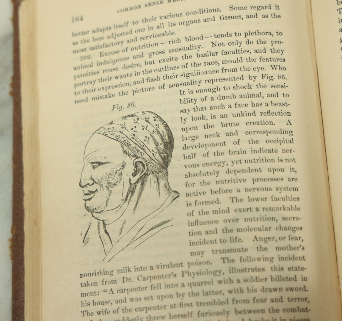 Lot 122 - "The People's Common Sense Medical Adviser In Plain English, Or, Medicine Simplified" Antique Illustrated Medical Book By R.V. Pierce, M.D., Twelfth Revised Edition, Buffalo, New York, 1883