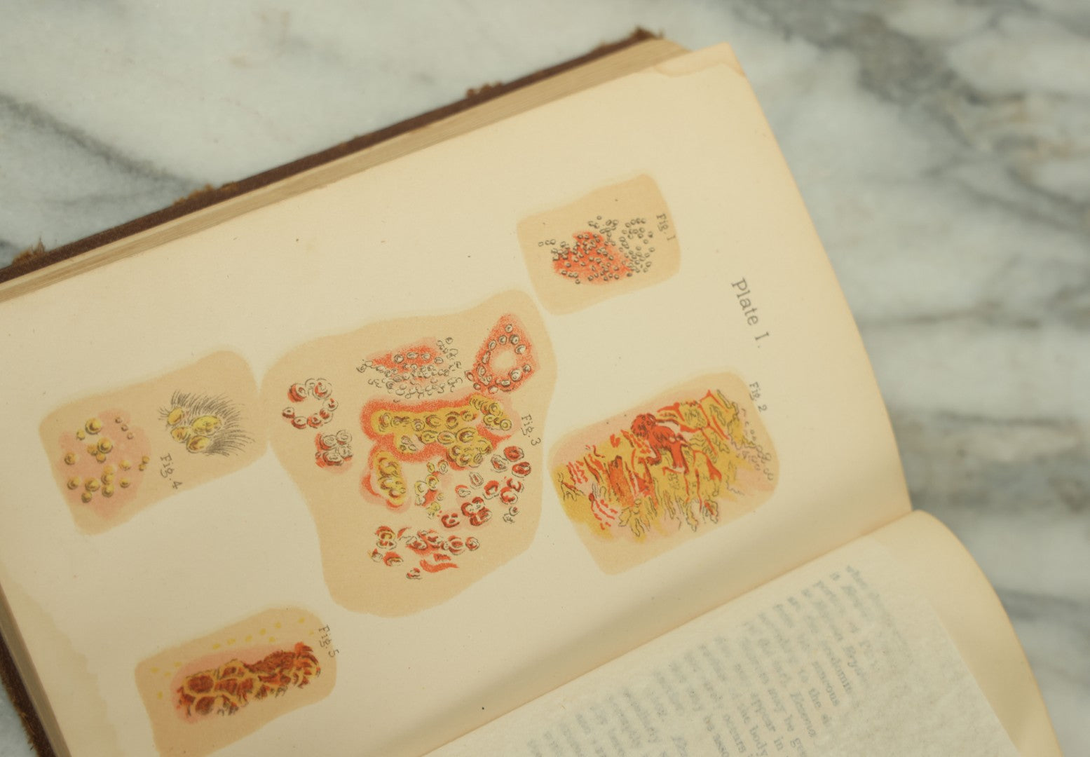 Lot 122 - "The People's Common Sense Medical Adviser In Plain English, Or, Medicine Simplified" Antique Illustrated Medical Book By R.V. Pierce, M.D., Twelfth Revised Edition, Buffalo, New York, 1883