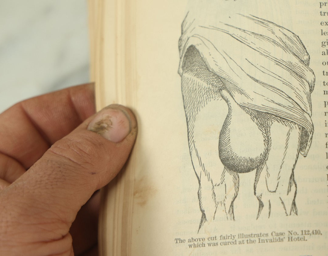 Lot 122 - "The People's Common Sense Medical Adviser In Plain English, Or, Medicine Simplified" Antique Illustrated Medical Book By R.V. Pierce, M.D., Twelfth Revised Edition, Buffalo, New York, 1883