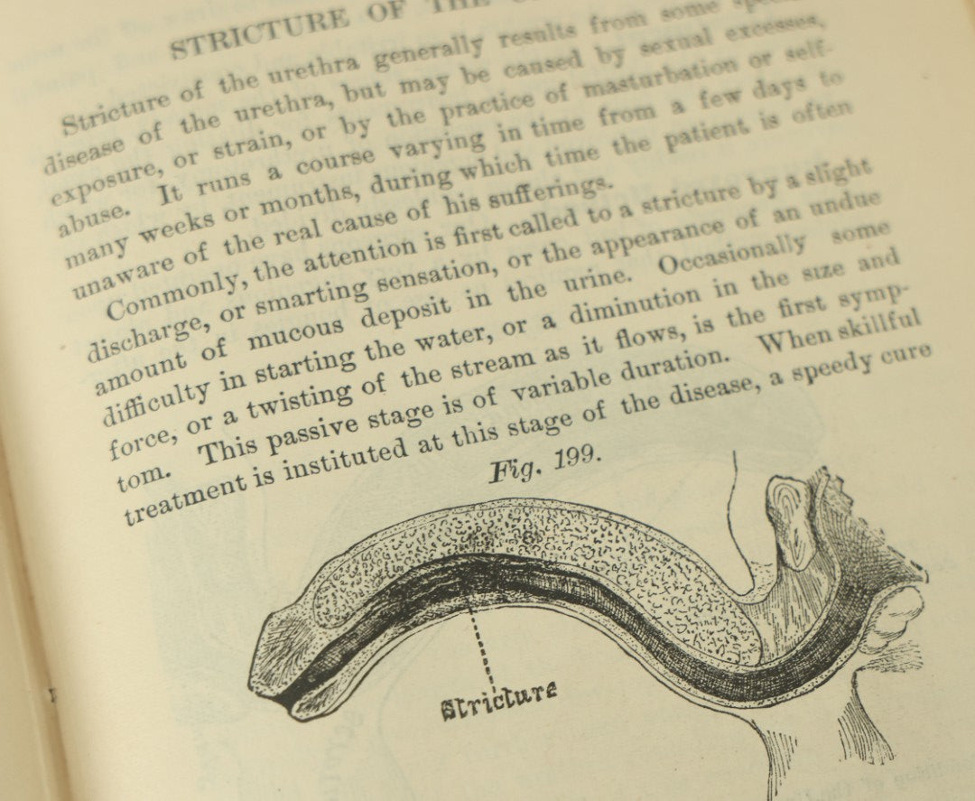 Lot 122 - "The People's Common Sense Medical Adviser In Plain English, Or, Medicine Simplified" Antique Illustrated Medical Book By R.V. Pierce, M.D., Twelfth Revised Edition, Buffalo, New York, 1883