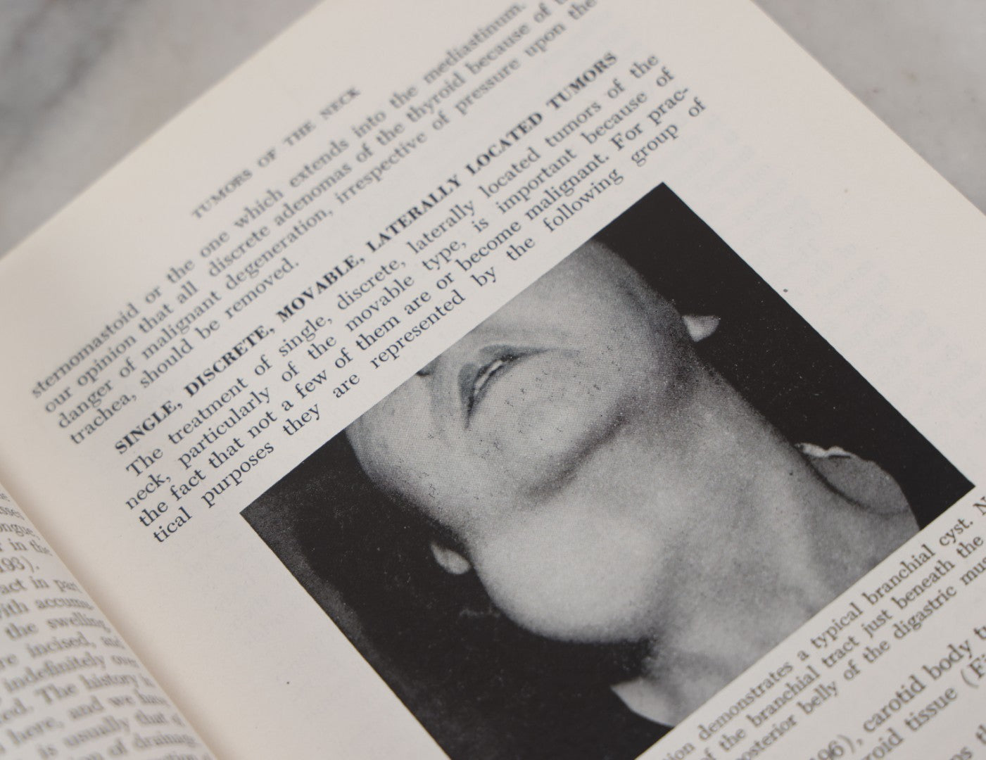Lot 110 - "The Surgical Clinics Of North America, June 1947, Tumors" Vintage Medical Book With Photographs Of Pathology, W.B. Sauders Company Publishers, 1947