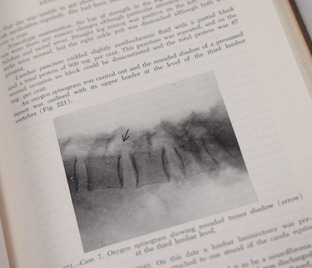 Lot 110 - "The Surgical Clinics Of North America, June 1947, Tumors" Vintage Medical Book With Photographs Of Pathology, W.B. Sauders Company Publishers, 1947