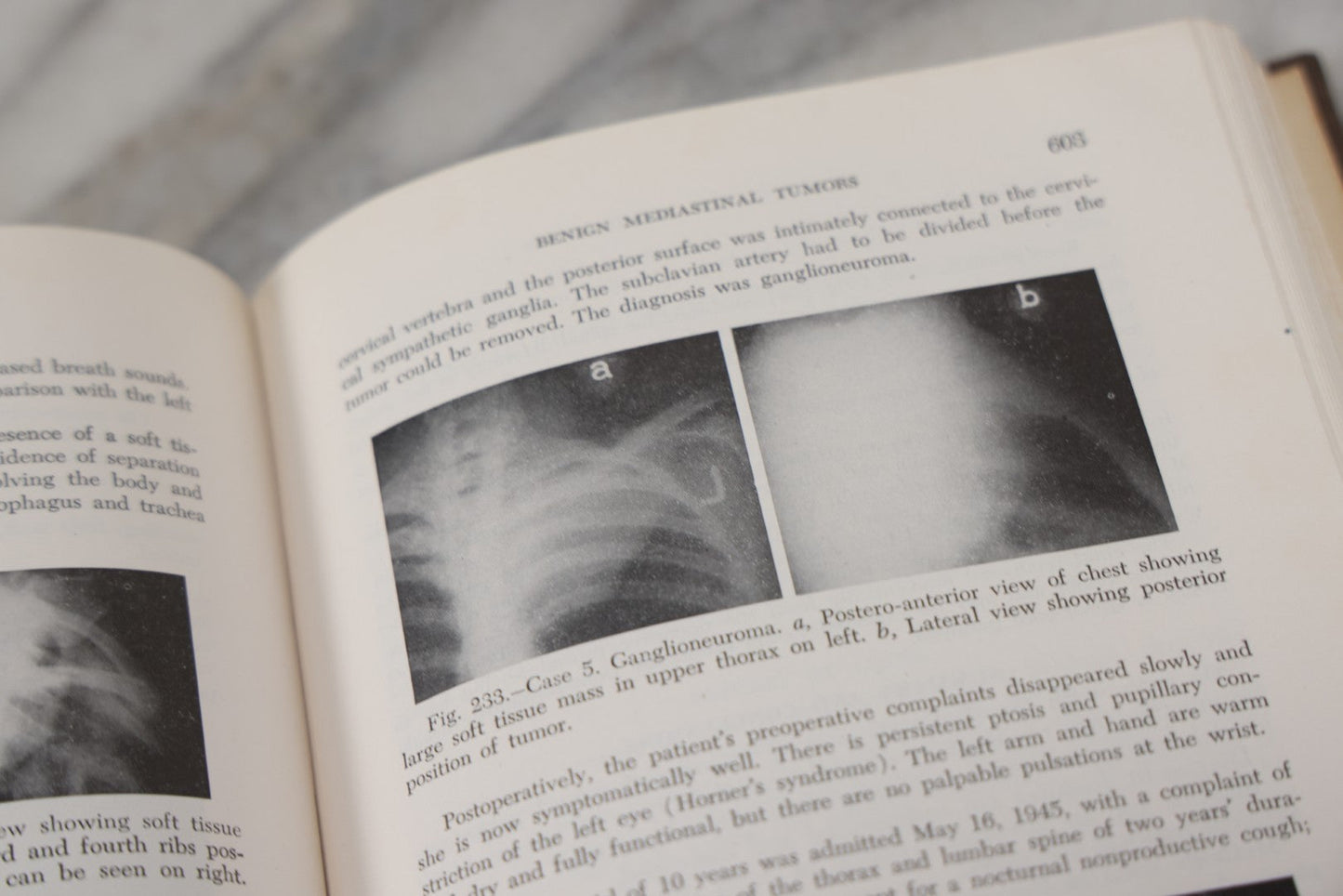 Lot 110 - "The Surgical Clinics Of North America, June 1947, Tumors" Vintage Medical Book With Photographs Of Pathology, W.B. Sauders Company Publishers, 1947