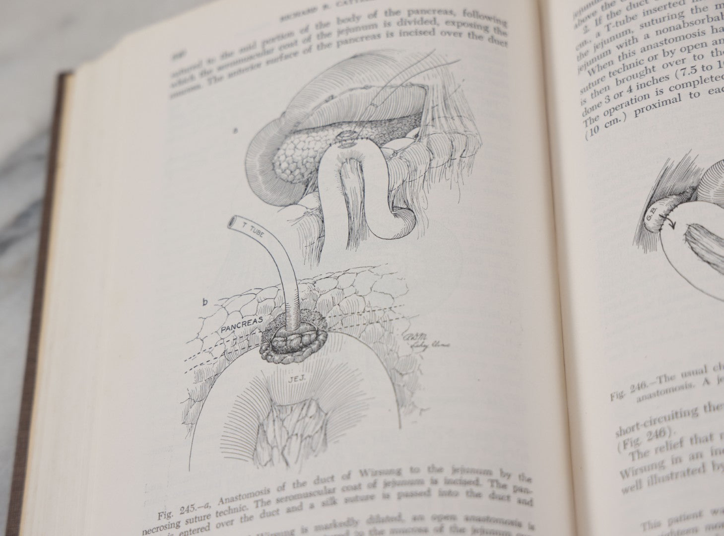 Lot 110 - "The Surgical Clinics Of North America, June 1947, Tumors" Vintage Medical Book With Photographs Of Pathology, W.B. Sauders Company Publishers, 1947
