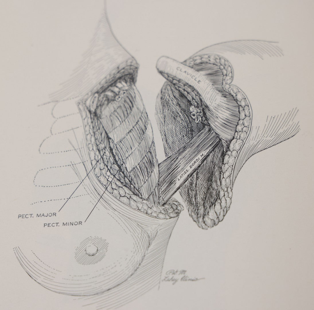 Lot 110 - "The Surgical Clinics Of North America, June 1947, Tumors" Vintage Medical Book With Photographs Of Pathology, W.B. Sauders Company Publishers, 1947