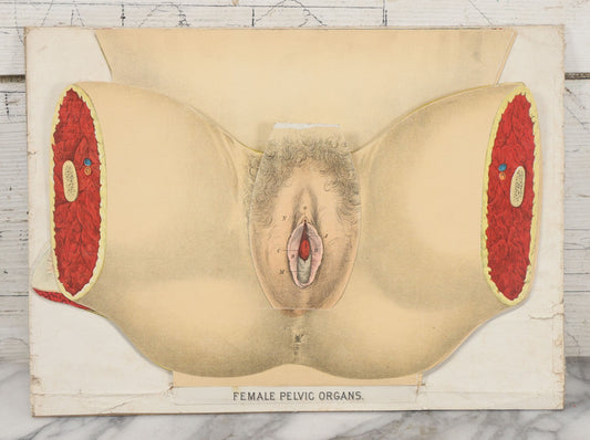 Lot 023 - Antique Medical Anatomy Bookplate Fold Out Diagram Of The Female Pelvic Organs, Folds Out To Show Details Of Anatomy, Mounted To Board, 14-1/2" x 10-1/2"