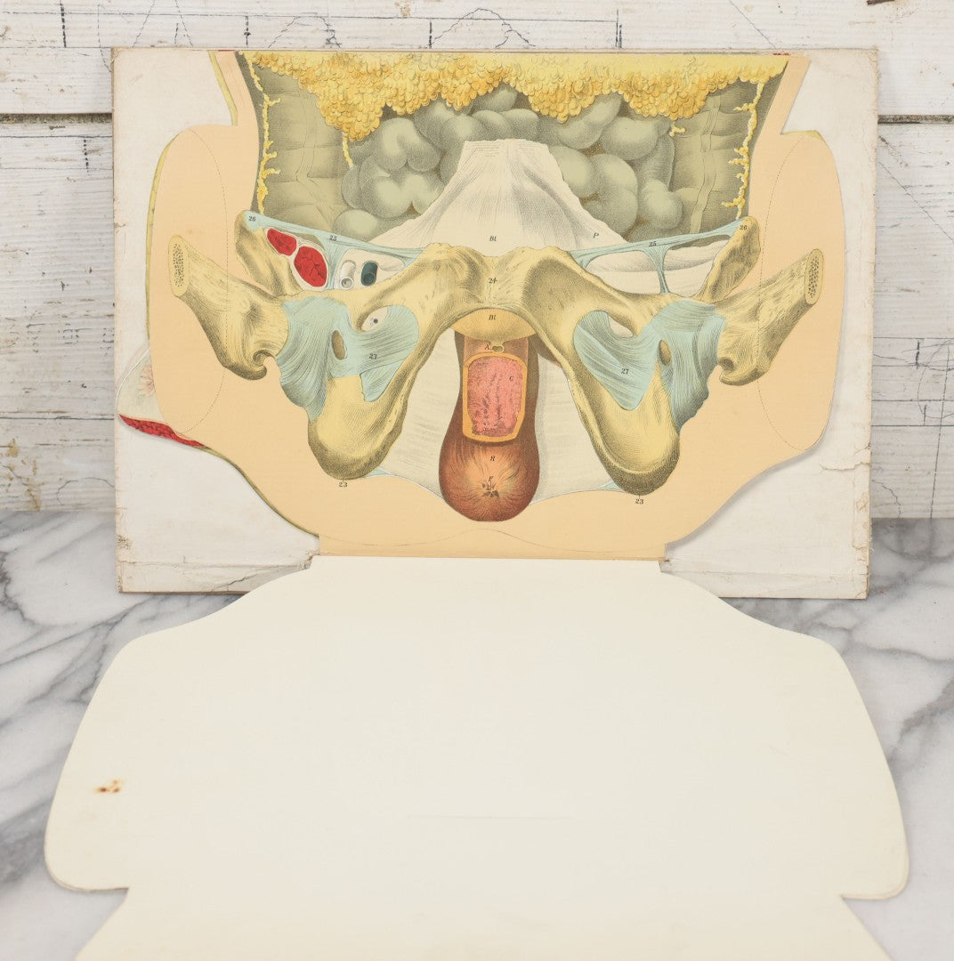 Lot 023 - Antique Medical Anatomy Bookplate Fold Out Diagram Of The Female Pelvic Organs, Folds Out To Show Details Of Anatomy, Mounted To Board, 14-1/2" x 10-1/2"