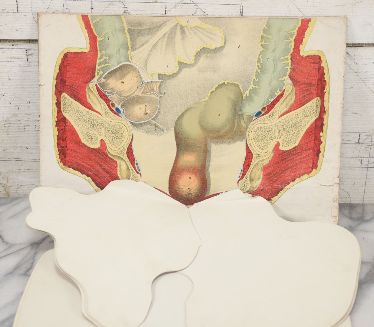 Lot 023 - Antique Medical Anatomy Bookplate Fold Out Diagram Of The Female Pelvic Organs, Folds Out To Show Details Of Anatomy, Mounted To Board, 14-1/2" x 10-1/2"
