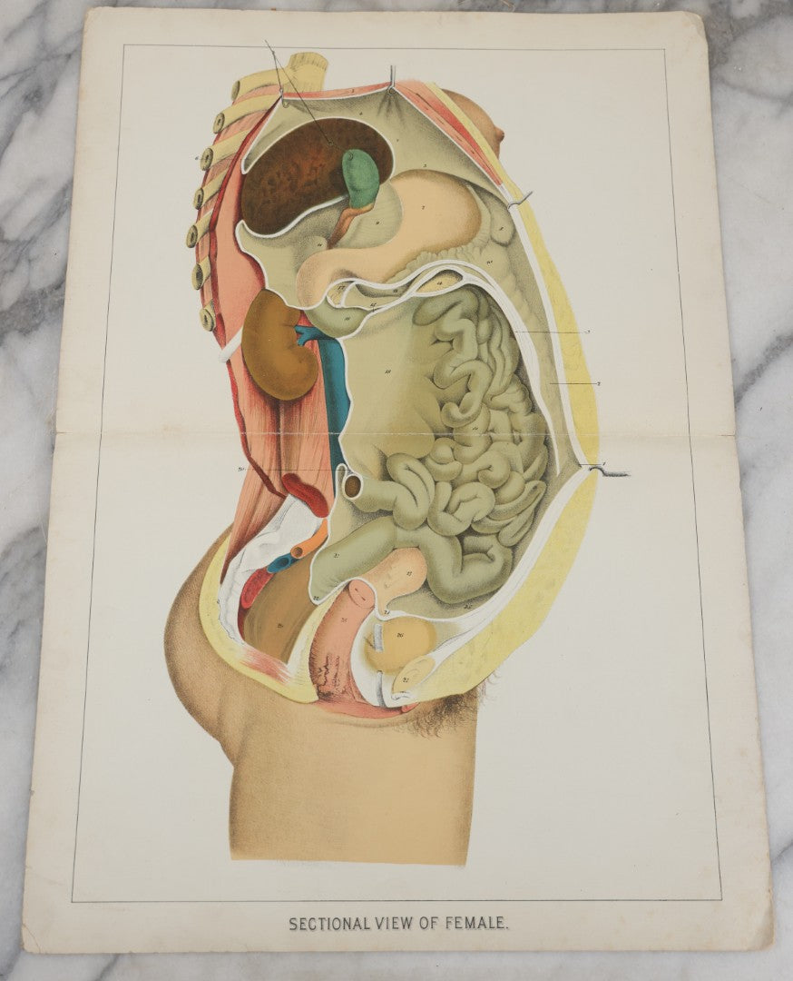 Lot 026 - Antique Medical Anatomy Bookplate Fold Out Double Wide Diagram Of The Sectional View Of The Female, 14-1/2" x 20-7/8"