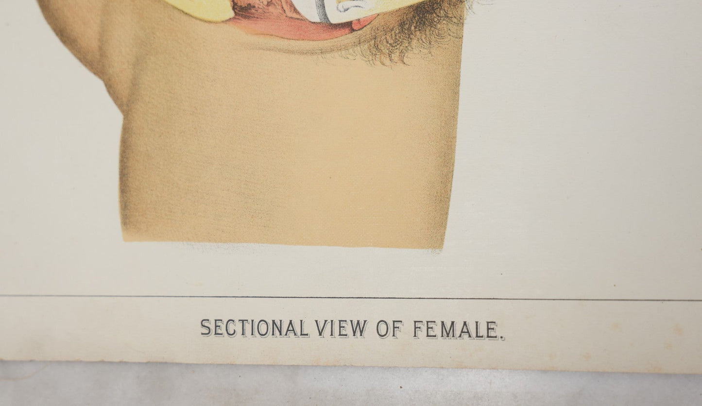 Lot 026 - Antique Medical Anatomy Bookplate Fold Out Double Wide Diagram Of The Sectional View Of The Female, 14-1/2" x 20-7/8"