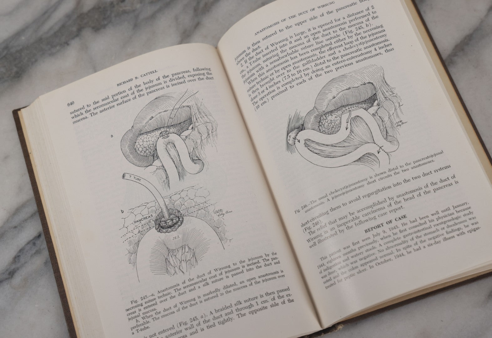 Lot 110 - "The Surgical Clinics Of North America, June 1947, Tumors" Vintage Medical Book With Photographs Of Pathology, W.B. Sauders Company Publishers, 1947