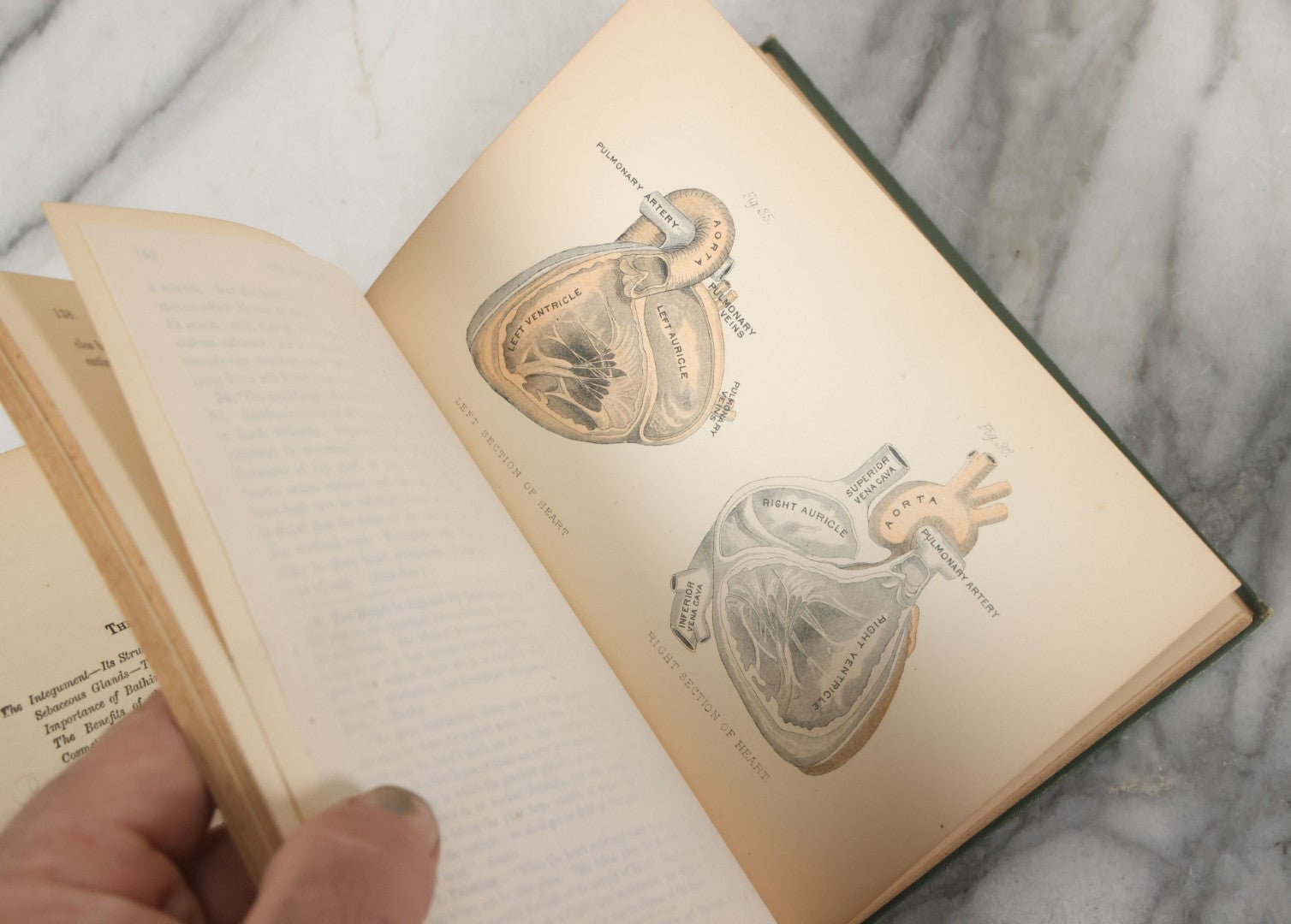 Lot 140 - "A Treatise On Physiology And Hygiene For Institutions And General Readers" Antique Book, By Joseph C. Hutchison, M.D., Fully Illustrated, Effingham Maynard And Co., Publishers, New York, 1891