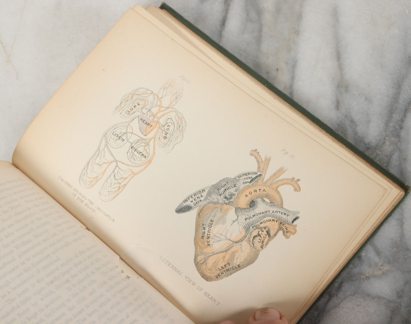 Lot 140 - "A Treatise On Physiology And Hygiene For Institutions And General Readers" Antique Book, By Joseph C. Hutchison, M.D., Fully Illustrated, Effingham Maynard And Co., Publishers, New York, 1891