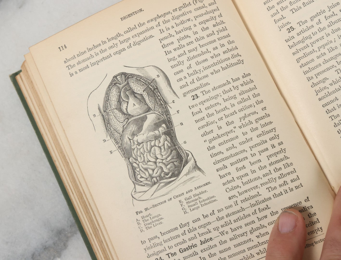 Lot 140 - "A Treatise On Physiology And Hygiene For Institutions And General Readers" Antique Book, By Joseph C. Hutchison, M.D., Fully Illustrated, Effingham Maynard And Co., Publishers, New York, 1891