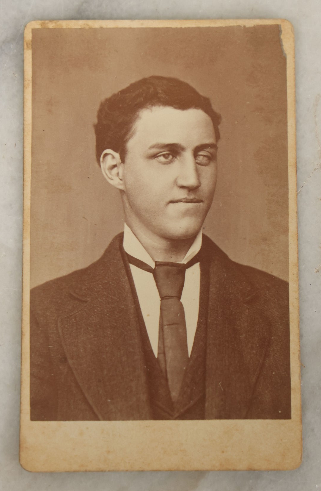Lot 049 - Antique Carte De Visite C.D.V. Photograph Of A Man With An Unknown Eye Disease, W.H. Wilson, Photographer, Batavia, New York, Identified Bigelow On Verso