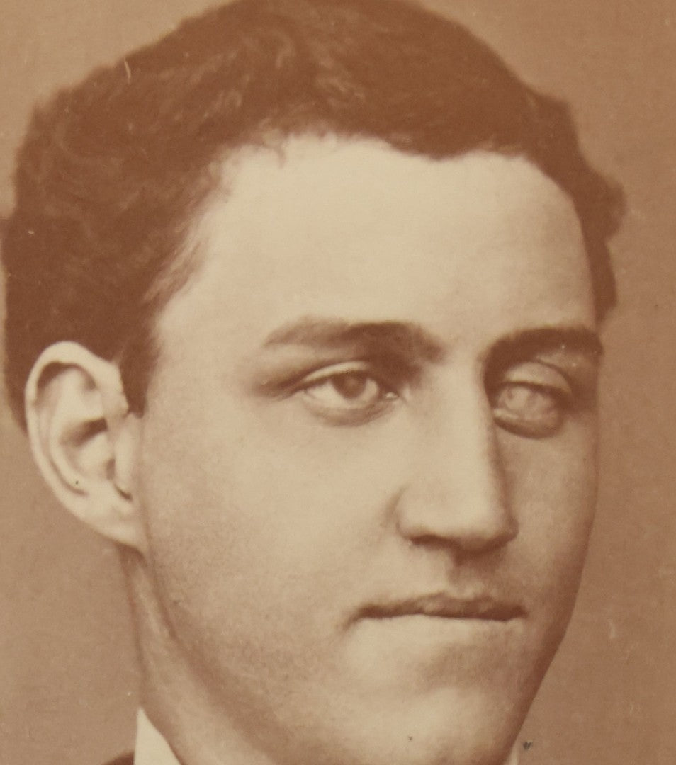Lot 049 - Antique Carte De Visite C.D.V. Photograph Of A Man With An Unknown Eye Disease, W.H. Wilson, Photographer, Batavia, New York, Identified Bigelow On Verso