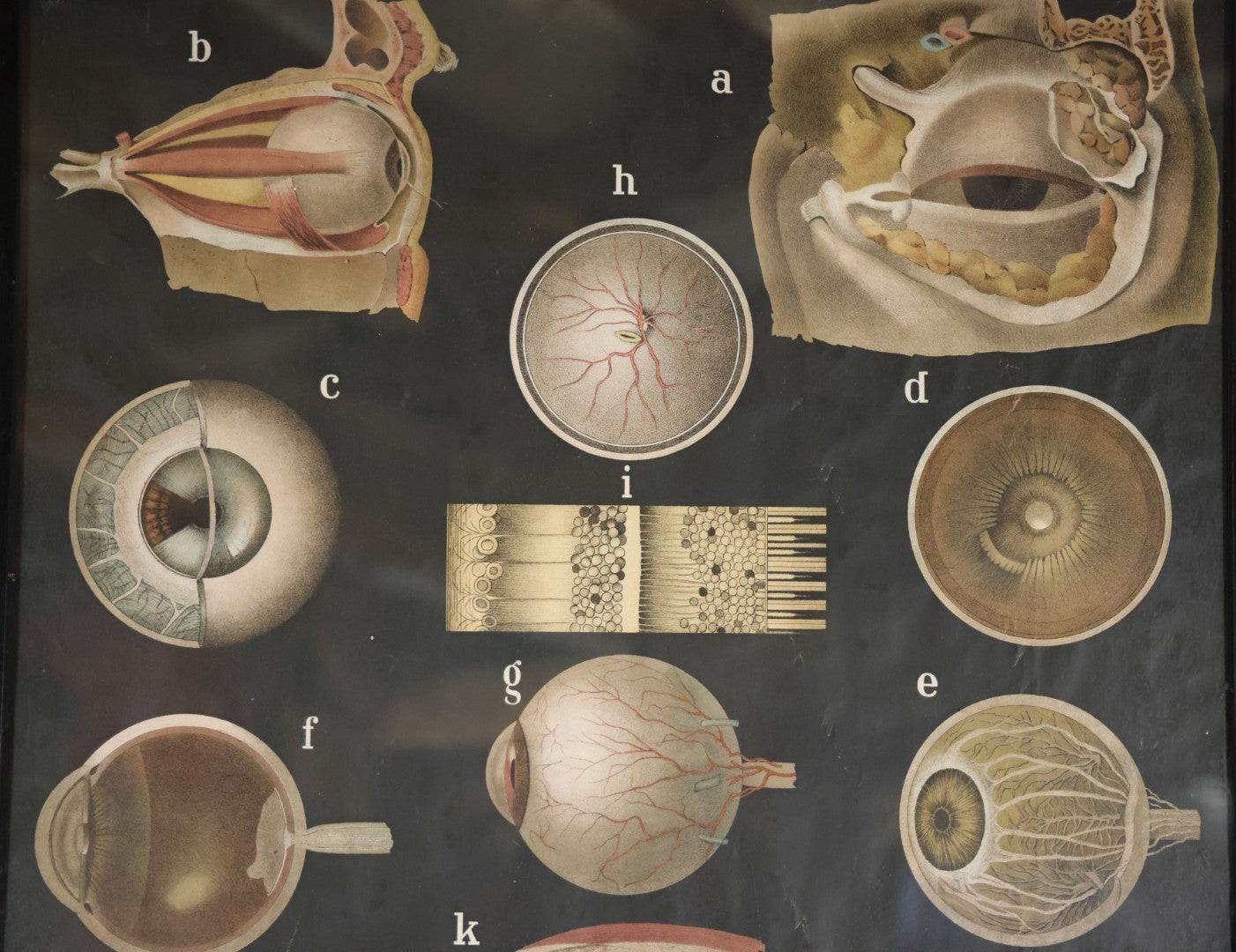 Antique Improved Gervais Chart Of The Eye No. 900 Anatomy Poster, Published By F.A. Hardy & Company, Chicago, In Frame. 29-3/8" x 37-3/8"