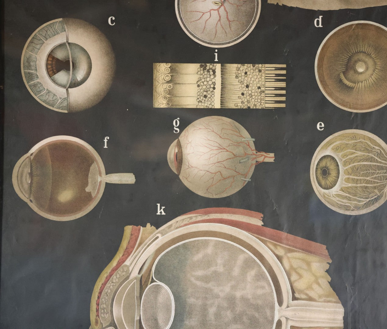 Antique Improved Gervais Chart Of The Eye No. 900 Anatomy Poster, Published By F.A. Hardy & Company, Chicago, In Frame. 29-3/8" x 37-3/8"