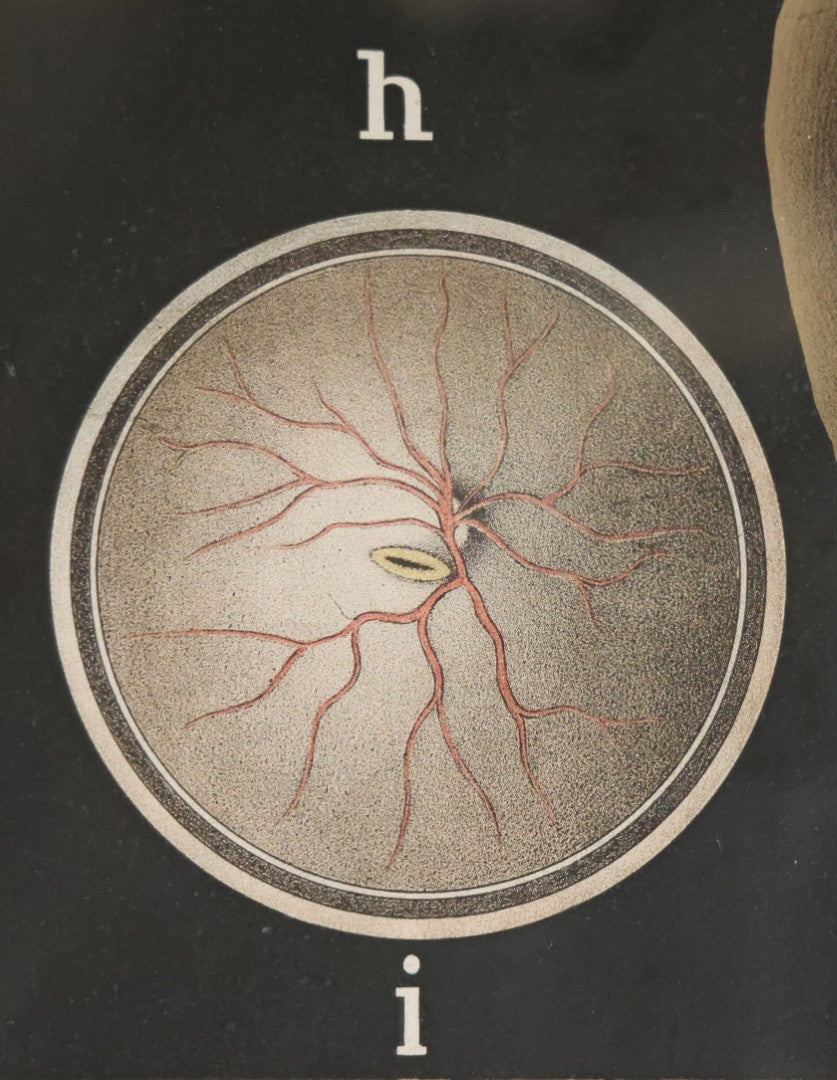 Antique Improved Gervais Chart Of The Eye No. 900 Anatomy Poster, Published By F.A. Hardy & Company, Chicago, In Frame. 29-3/8" x 37-3/8"
