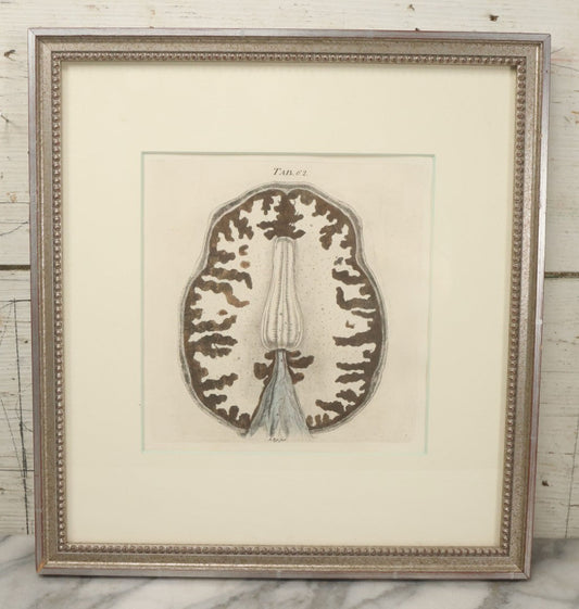 Lot 059 - Antique Late 18th Century Aquatint Anatomical Print, Plate 62, View Of The Brain, By A. Fyfe, In Modern Frame, 14-1/4" x 15-1/4"