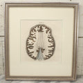 Lot 059 - Antique Late 18th Century Aquatint Anatomical Print, Plate 62, View Of The Brain, By A. Fyfe, In Modern Frame, 14-1/4" x 15-1/4"