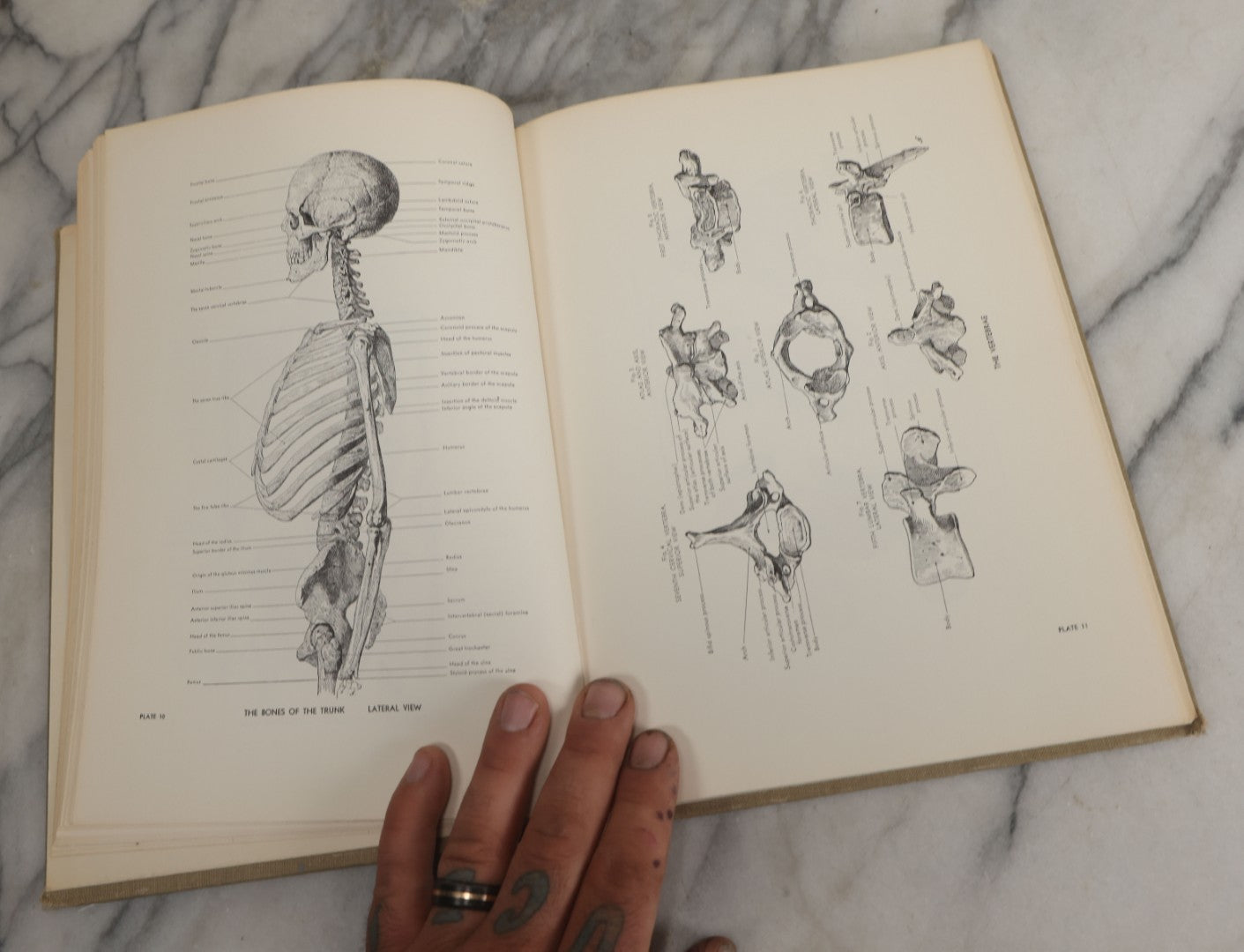 Lot 152 - "An Atlas Of Anatomy For Artists" Vintage Profusely Illustrated Anatomy Drawing Book By Fritz Schider, Dover Publications Inc., New York, 1957, Third American Edition