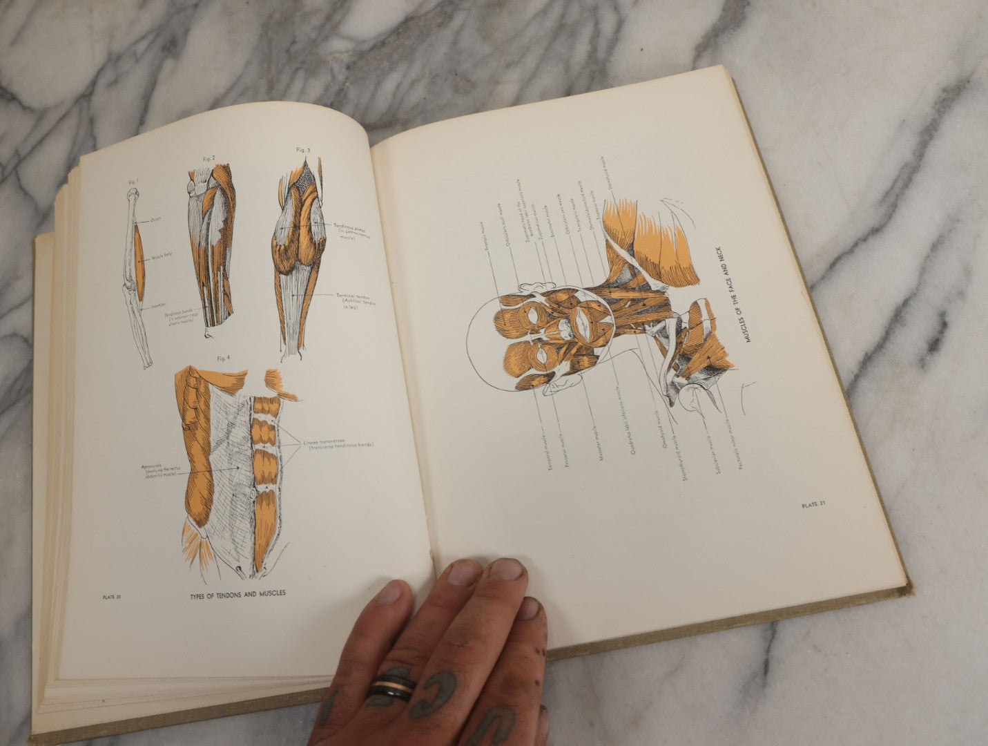 Lot 152 - "An Atlas Of Anatomy For Artists" Vintage Profusely Illustrated Anatomy Drawing Book By Fritz Schider, Dover Publications Inc., New York, 1957, Third American Edition