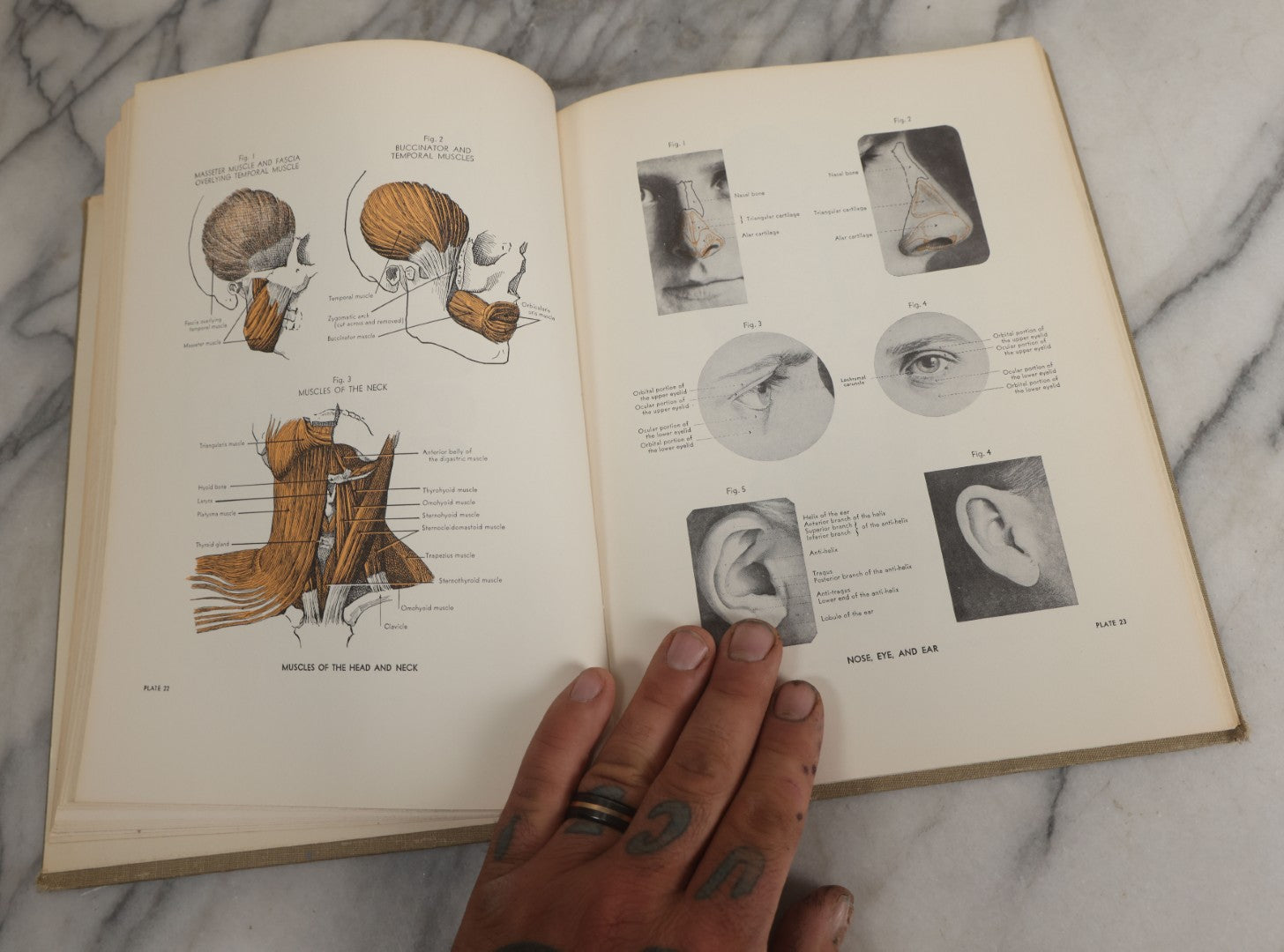 Lot 152 - "An Atlas Of Anatomy For Artists" Vintage Profusely Illustrated Anatomy Drawing Book By Fritz Schider, Dover Publications Inc., New York, 1957, Third American Edition