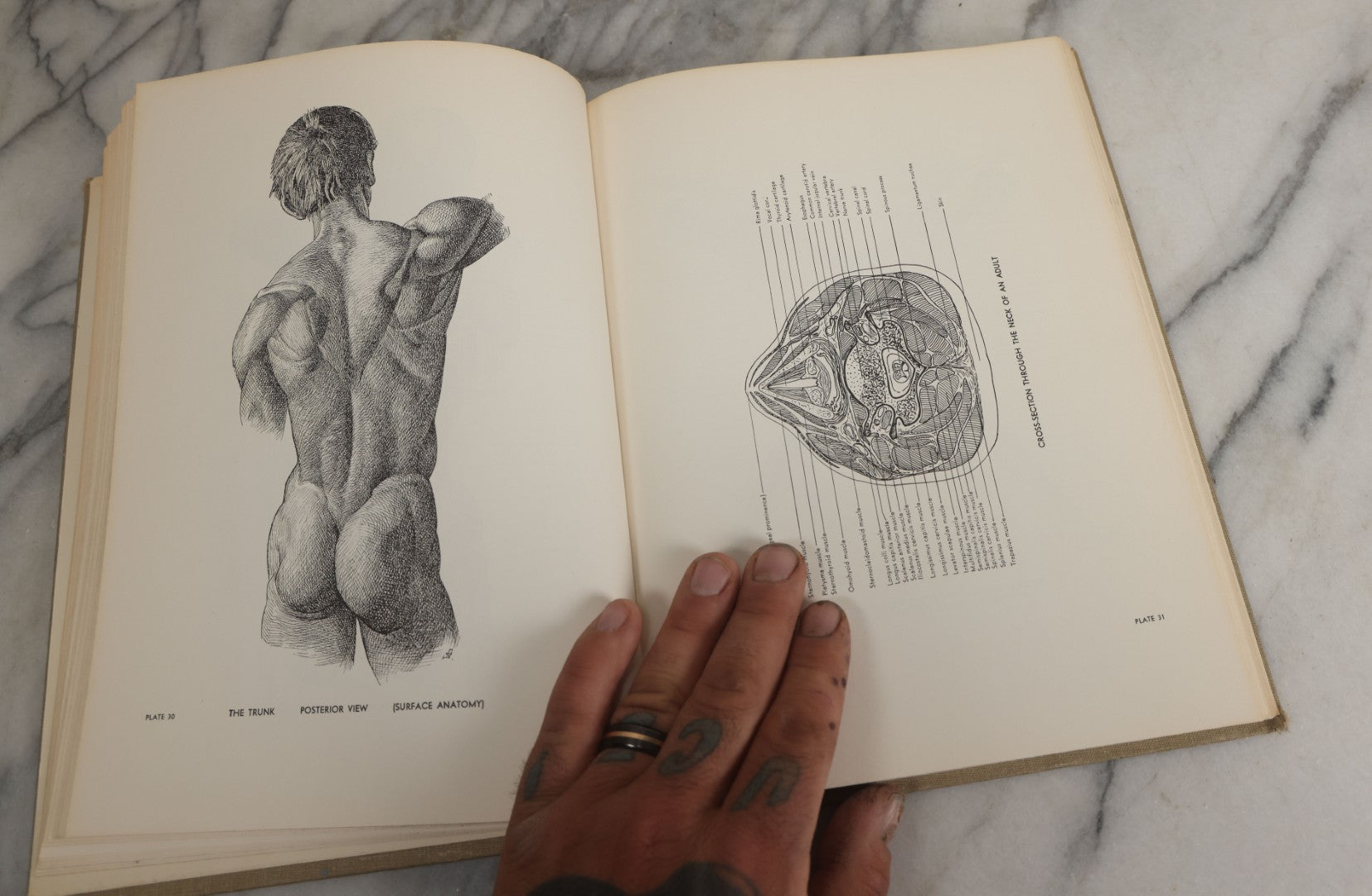Lot 152 - "An Atlas Of Anatomy For Artists" Vintage Profusely Illustrated Anatomy Drawing Book By Fritz Schider, Dover Publications Inc., New York, 1957, Third American Edition