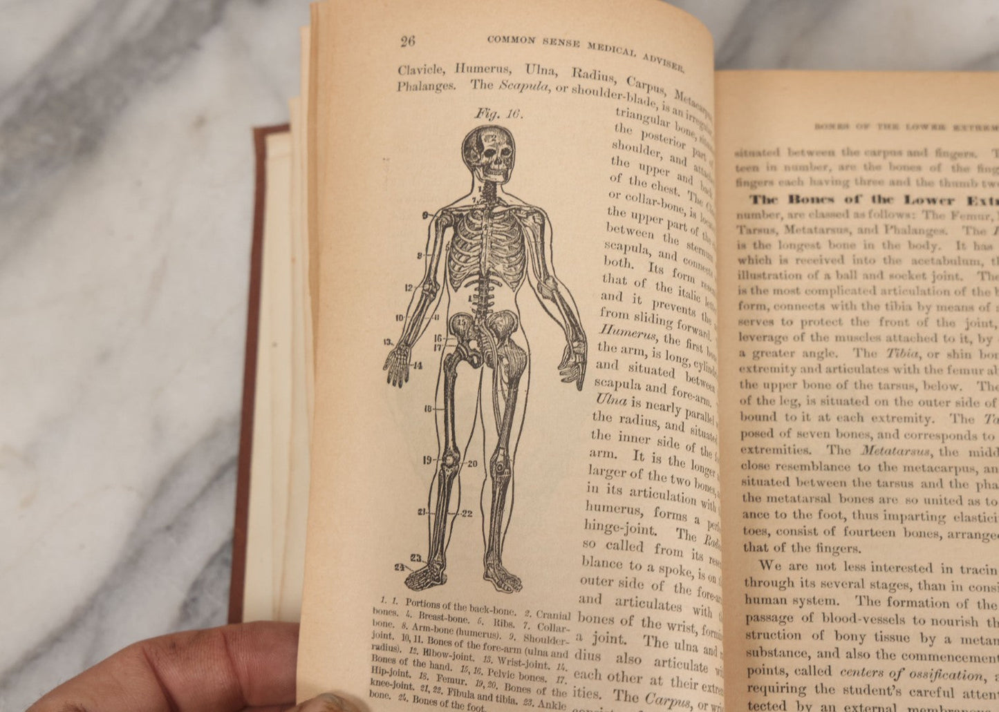 Lot 003 - "The People's Common Sense Medical Adviser In Plain English; Or Medicine Simplified" Antique Book By R.V. Pierce, M.D., 21st Edition, Illustrated, 1889