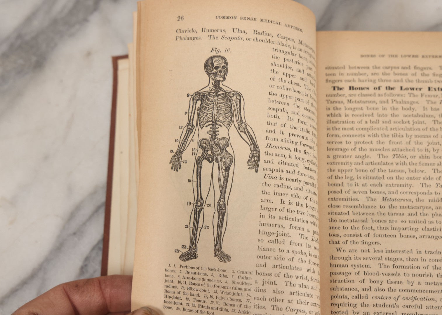 Lot 003 - "The People's Common Sense Medical Adviser In Plain English; Or Medicine Simplified" Antique Book By R.V. Pierce, M.D., 21st Edition, Illustrated, 1889