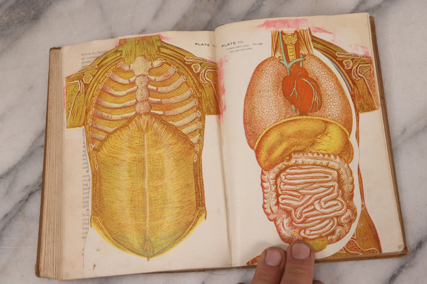 Lot 129 - "Lessons In Hygienic Physiology" Antique Illustrated Medical Book By Walter Moore Coleman, The Macmillan Company, Publisher, New York, 1914, Note Coloring And Pencil Marks Throughout, Many Illustrations Cut Out Of Book
