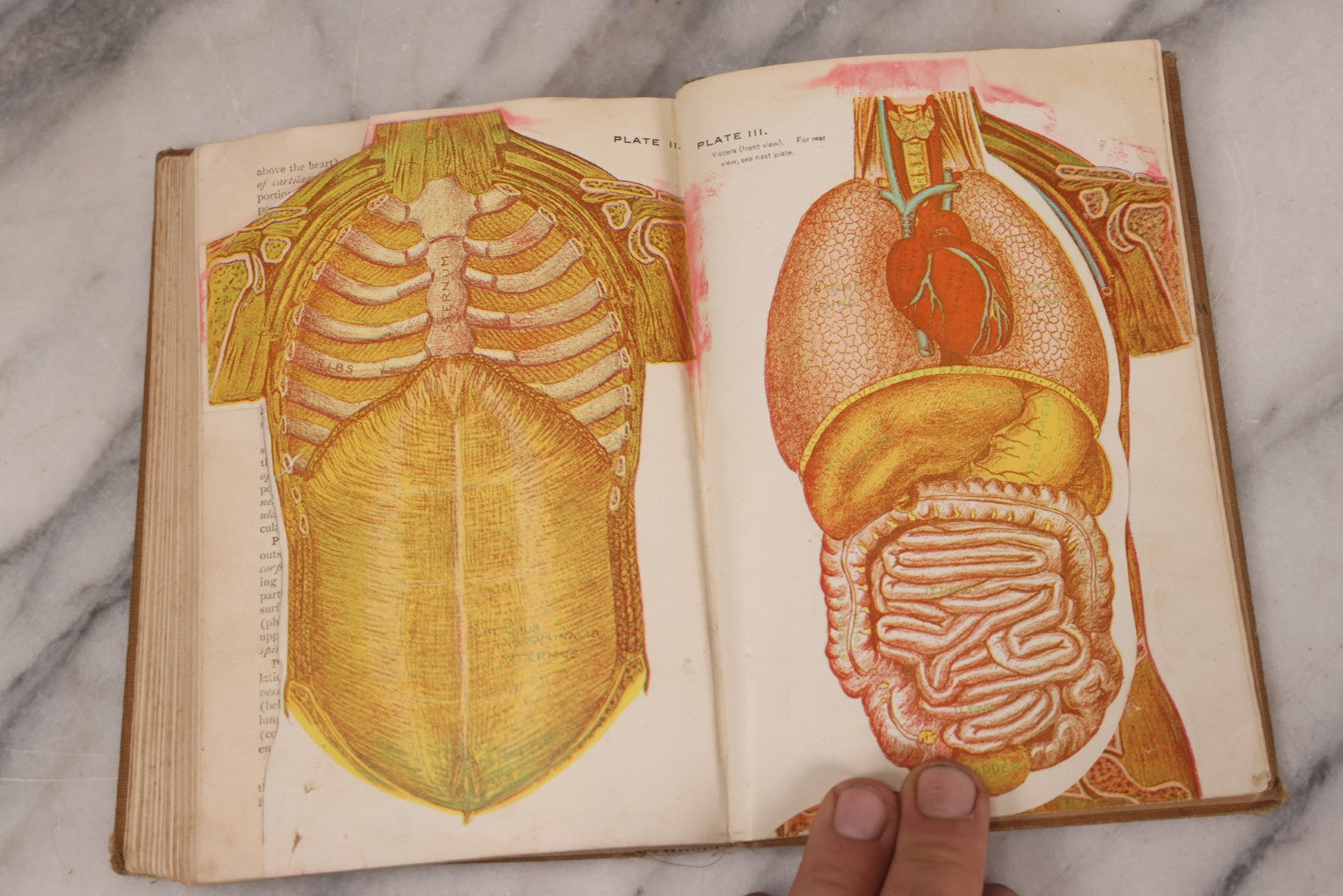 Lot 129 - "Lessons In Hygienic Physiology" Antique Illustrated Medical Book By Walter Moore Coleman, The Macmillan Company, Publisher, New York, 1914, Note Coloring And Pencil Marks Throughout, Many Illustrations Cut Out Of Book