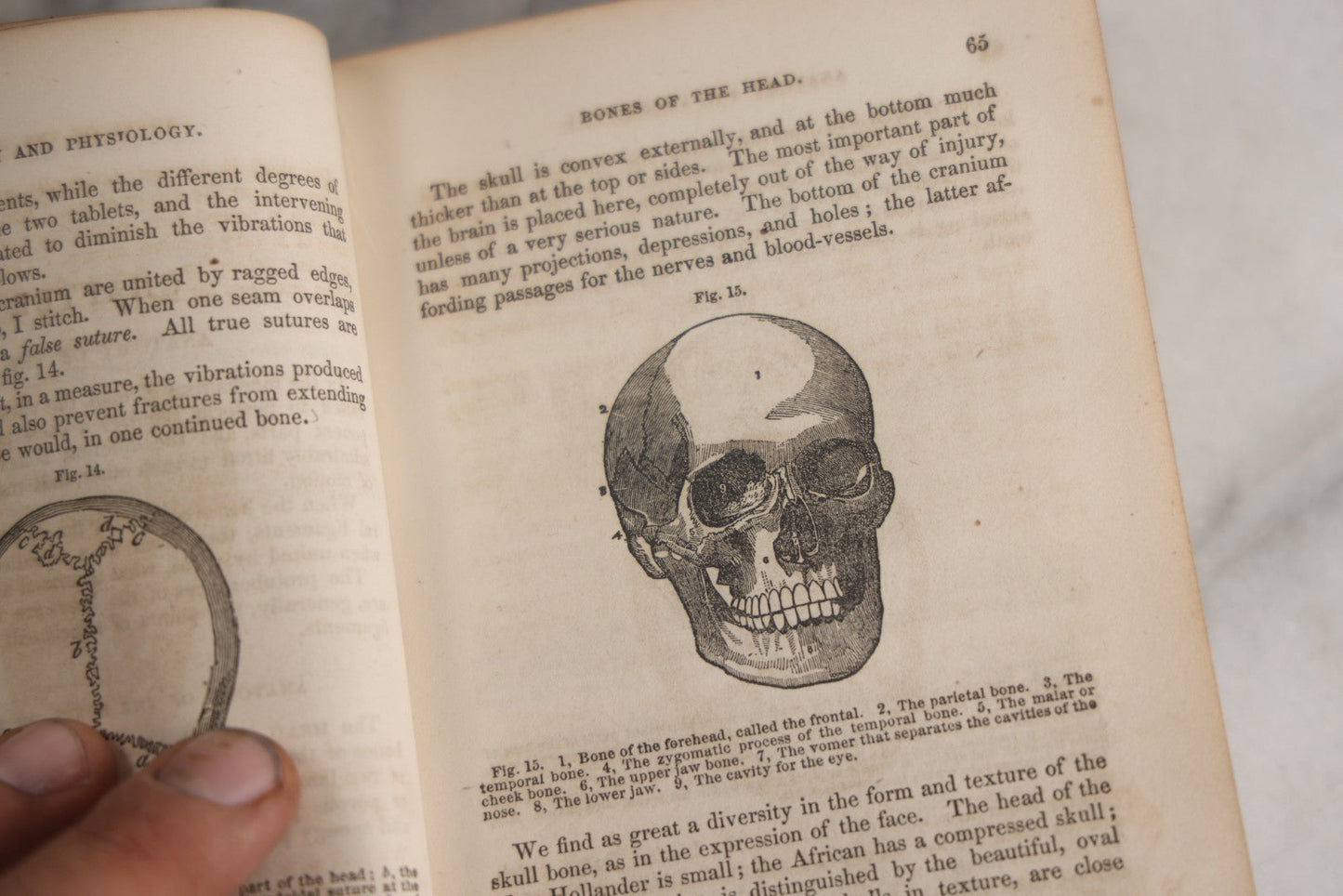Lot 171 - "Anatomy And Physiology: Designed For Academies And Families" Antique Medical Book By Calvin Cutter, M.D., Sixth Stereotype Edition, Illustrated With Over 200 Engravings, Benjamin B. Mussey & Co., Publishers, Boston, 1847, Note Missing Covers