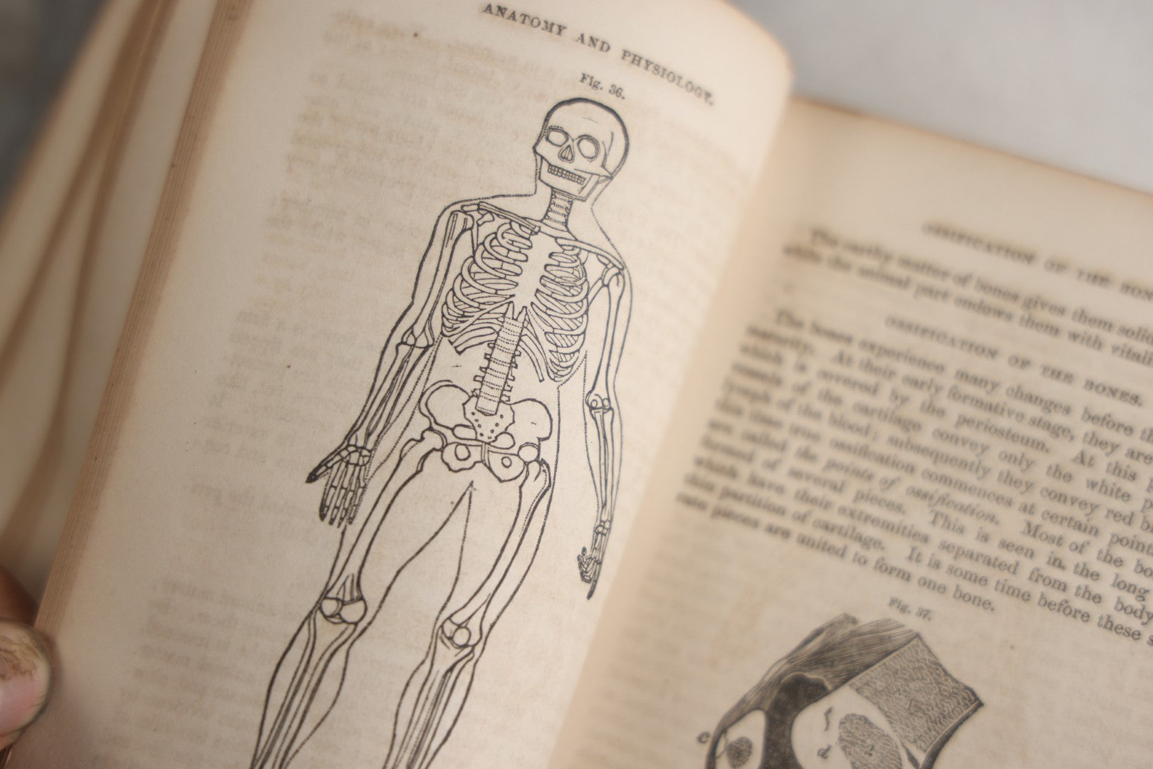 Lot 171 - "Anatomy And Physiology: Designed For Academies And Families" Antique Medical Book By Calvin Cutter, M.D., Sixth Stereotype Edition, Illustrated With Over 200 Engravings, Benjamin B. Mussey & Co., Publishers, Boston, 1847, Note Missing Covers
