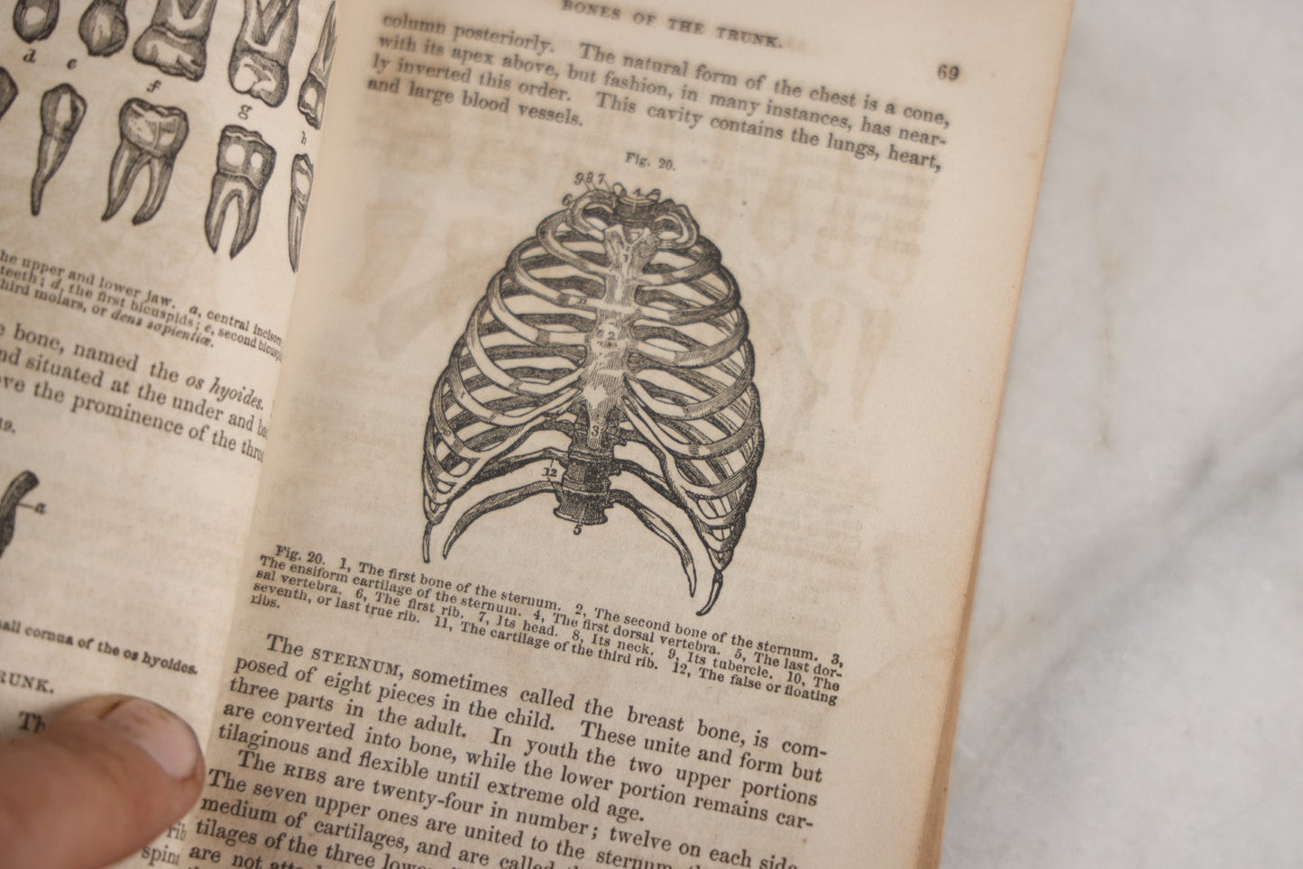 Lot 171 - "Anatomy And Physiology: Designed For Academies And Families" Antique Medical Book By Calvin Cutter, M.D., Sixth Stereotype Edition, Illustrated With Over 200 Engravings, Benjamin B. Mussey & Co., Publishers, Boston, 1847, Note Missing Covers