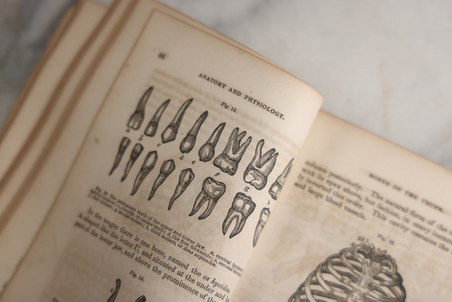 Lot 171 - "Anatomy And Physiology: Designed For Academies And Families" Antique Medical Book By Calvin Cutter, M.D., Sixth Stereotype Edition, Illustrated With Over 200 Engravings, Benjamin B. Mussey & Co., Publishers, Boston, 1847, Note Missing Covers