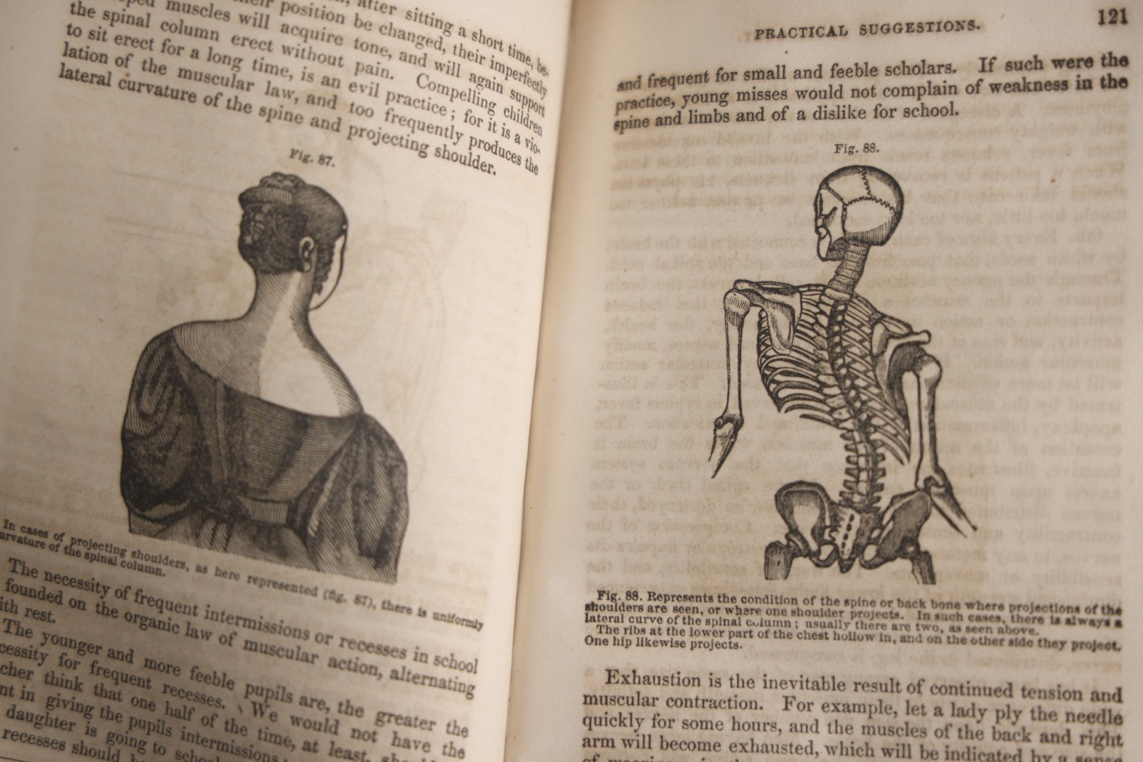 Lot 171 - "Anatomy And Physiology: Designed For Academies And Families" Antique Medical Book By Calvin Cutter, M.D., Sixth Stereotype Edition, Illustrated With Over 200 Engravings, Benjamin B. Mussey & Co., Publishers, Boston, 1847, Note Missing Covers